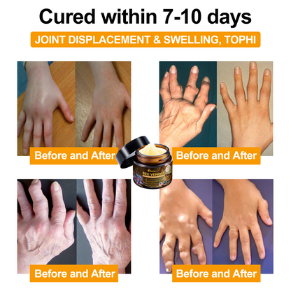 Official Store:  🦵Aetheris™ Bee Venom Arthritis Therapy Cream(Specially for older adults & AAOS recommends)🔥𝑳𝒂𝒔𝒕 𝒅𝒂𝒚 𝒑𝒓𝒐𝒎𝒐𝒕𝒊𝒐𝒏 7𝟎% 𝒐𝒇𝒇